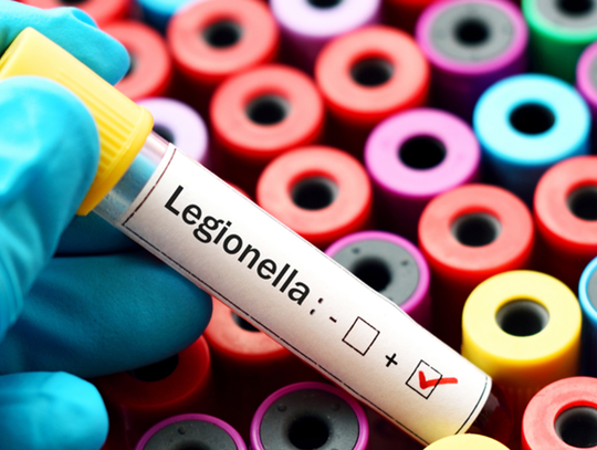 Legionella w wodzie pitnej. Pół szpitala natychmiast zamknięte Legionella w wodzie pitnej. Pół szpitala natychmiast zamknięte