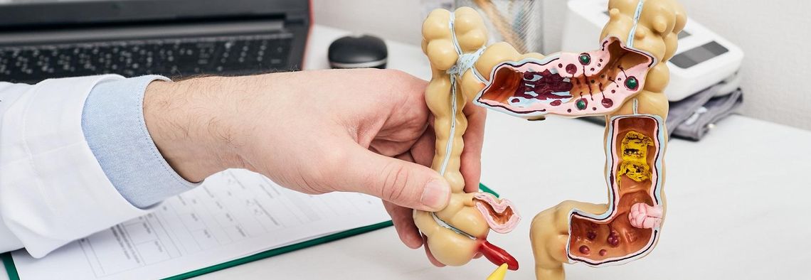 NOWOTWÓR WYKRYTY NA WCZESNYM ETAPIE MOŻE BYĆ CAŁKOWICIE WYLECZALNY NOWOTWÓR WYKRYTY NA WCZESNYM ETAPIE MOŻE BYĆ CAŁKOWICIE WYLECZALNY