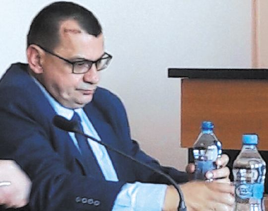 NIKT NIE NAPADŁ STAROSTY SAM SIĘ WALNĄŁ W GŁOWĘ